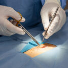 Varun Group - Treatment & Procedures